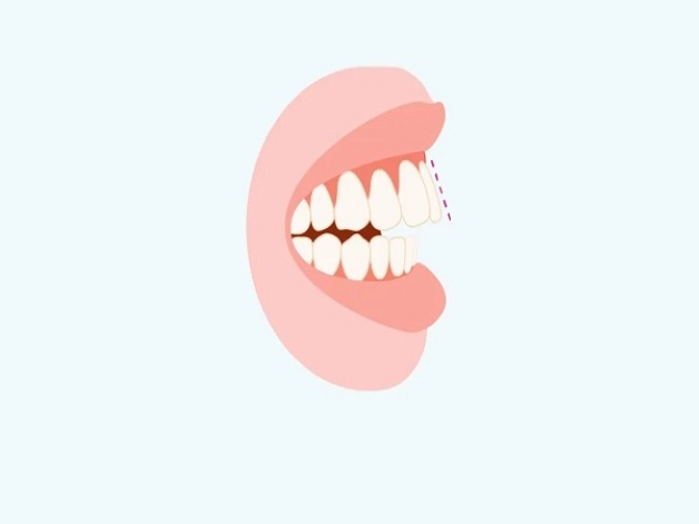hô hàm