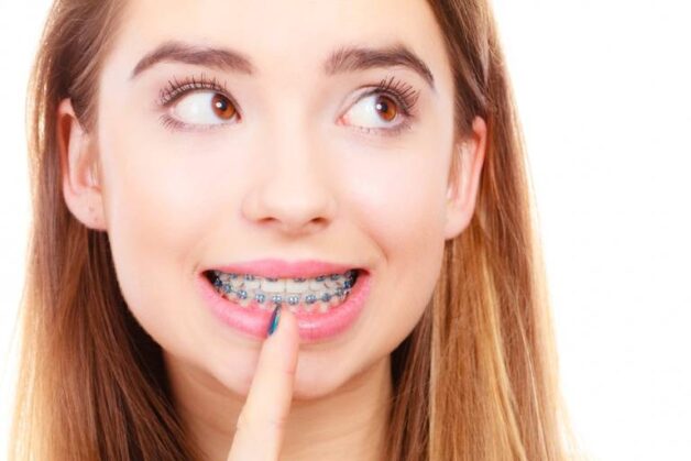 địa chỉ niềng răng ở Hà Nội