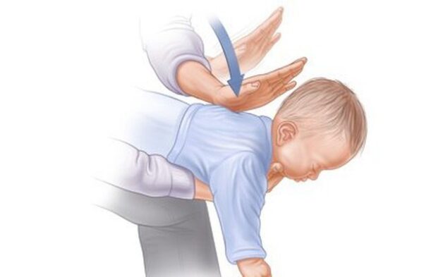 Cách chữa Nuốt xương cá