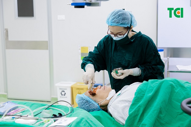 nâng cơ mí mắt tại phòng mổ