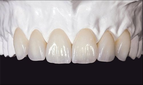 Răng sứ cao cấp Zirconia