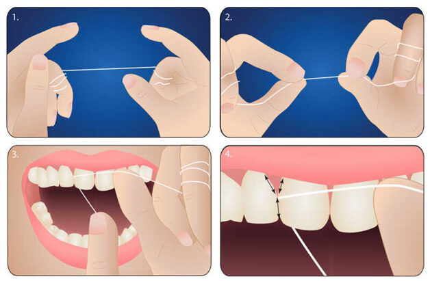 cách làm sạch cao răng tại nhà
