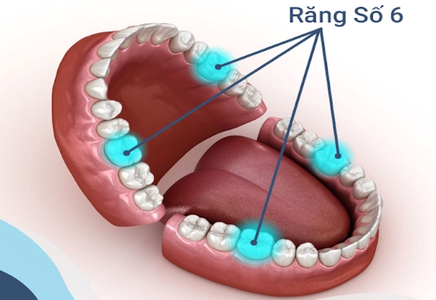 sâu răng cấm