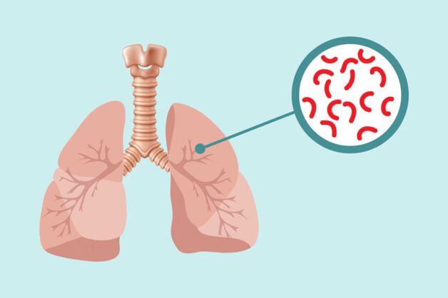 Tác hại của bệnh lao phổi nghiêm trọng