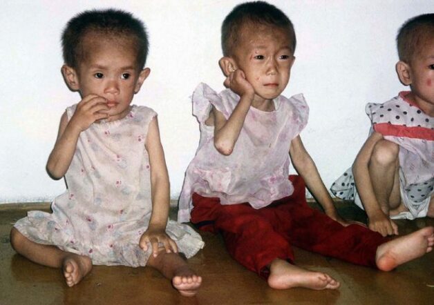 Thuốc bổ cho trẻ suy dinh dưỡng