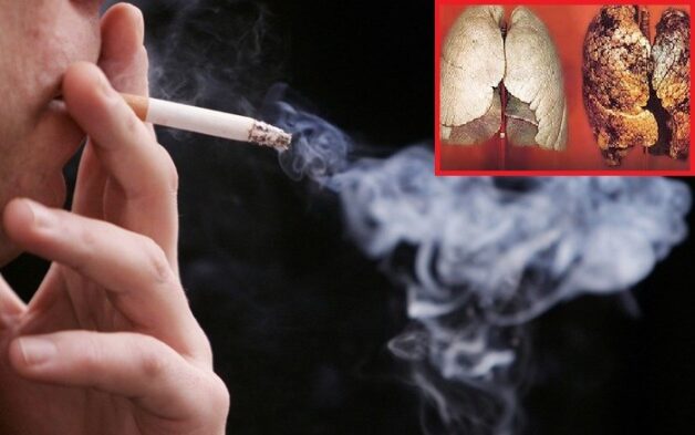 nguyên nhân viêm phổi khi trời trở lạnh