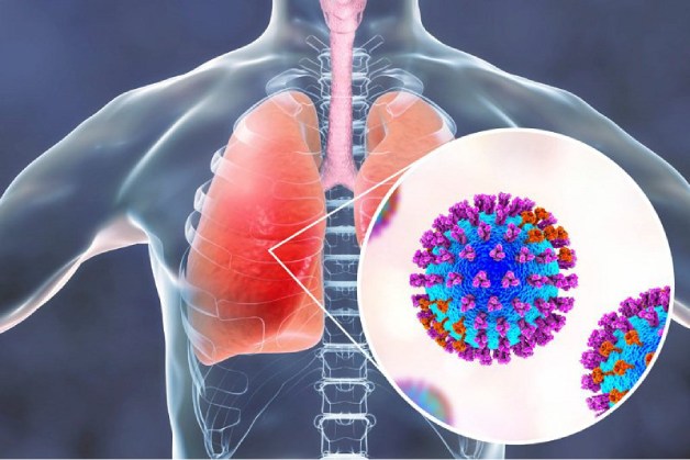 tiêm ngừa vaccine viêm phổi do phế cầu khuẩn