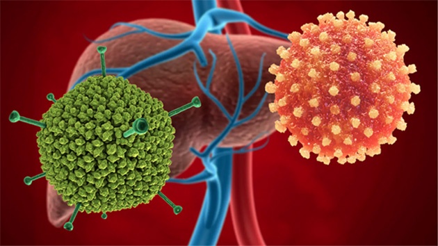 Viêm gan A à một bệnh nhiễm trùng cấp tính ở gan do virus viêm gan A (HAV) gây ra