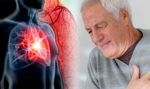 trào ngược dạ dày gây loạn nhịp tim