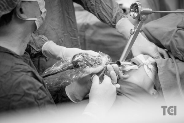 Quá trình phẫu thuật cắt polyp dây thanh sẽ được tiến hành thông qua đường miệng