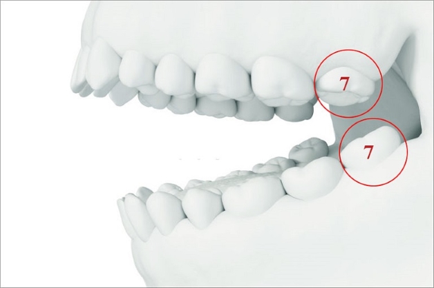 răng số 7 mọc khi nào bạn có biết