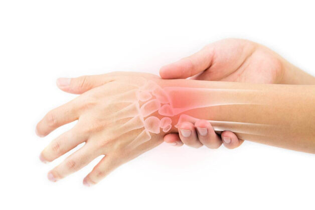 Điều trị viêm bao gân cổ tay có mục tiêu cải thiện triệu chứng sưng đau