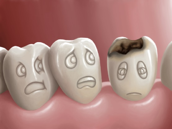 điều trị viêm lợi trong cùng
