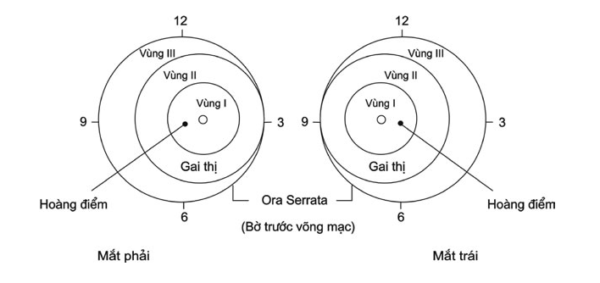 võng mạc non vùng 1