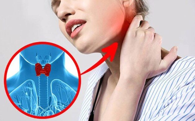 Suy tuyến giáp khiến người bệnh khó chịu