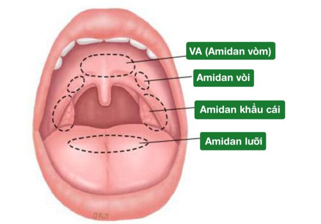 tìm hiểu bệnh viêm amidan