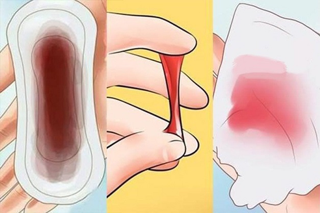 Dấu hiệu của bệnh ung thư cổ tử cung giai đoạn đầu