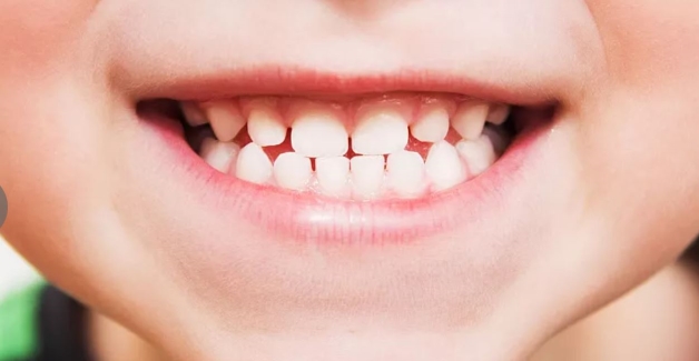 Khám răng cho bé ở đâu tốt?
