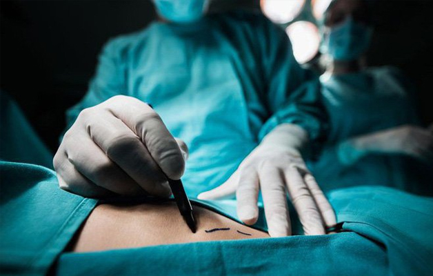 Mổ u tuyến giáp có bị tái phát không phụ thuộc vào nhiều yếu tố.