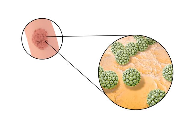 nam giới tiêm phòng hpv với vắc xin Gardasil 9 sẽ phòng được các chủng HPV: 6, 11, 16, 18, 31, 33, 45, 52 và 58