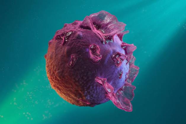 Nhiễm virus Epstein-Barr (EBV) có thể gây ra căn bệnh NPC
