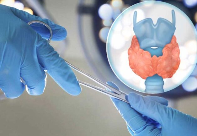 Tìm hiểu các phương pháp chữa trị ung thư tuyến giáp