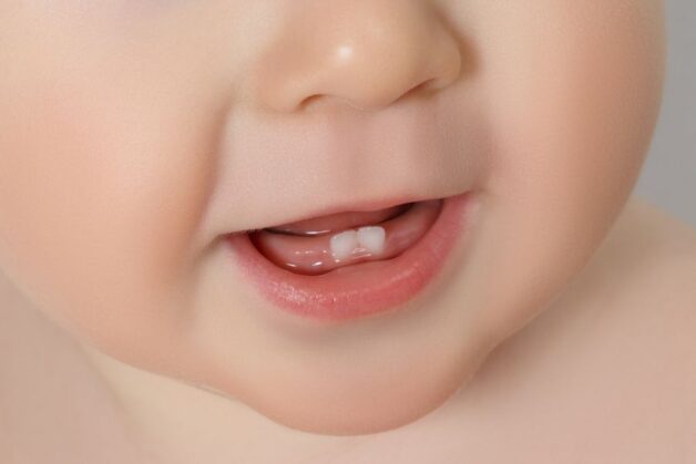 Khi mọc răng, trẻ có thể sốt nhẹ, kèm chảy nước miếng, ăn kém, ngủ kém, quấy khóc.