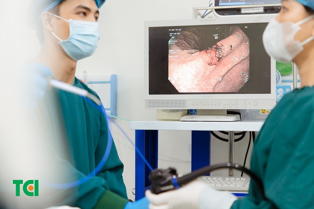 sàng lọc sớm ung thư đại tràng