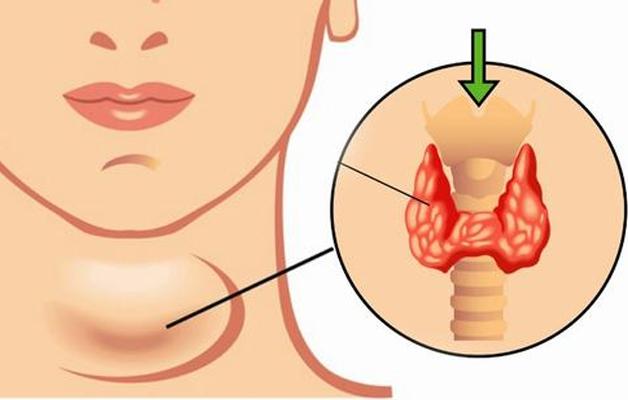 Tuyến giáp là tuyến nội tiết hình bướm, nằm ở vùng cổ trước, ngay trên xương ức.