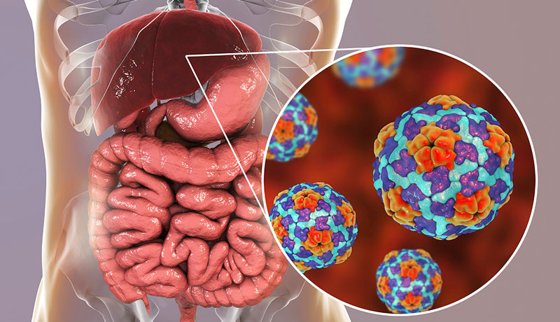 Virus viêm gan A (HAV) gây ra viêm gan A