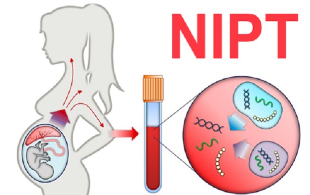 xét nghiệm sàng lọc nipt
