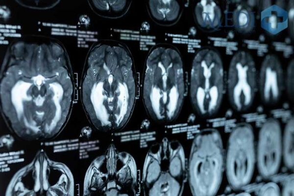 Ưu điểm của chụp MRI