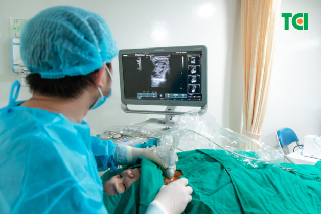 Đốt sóng cao tần điều trị nang tuyến giáp là gì