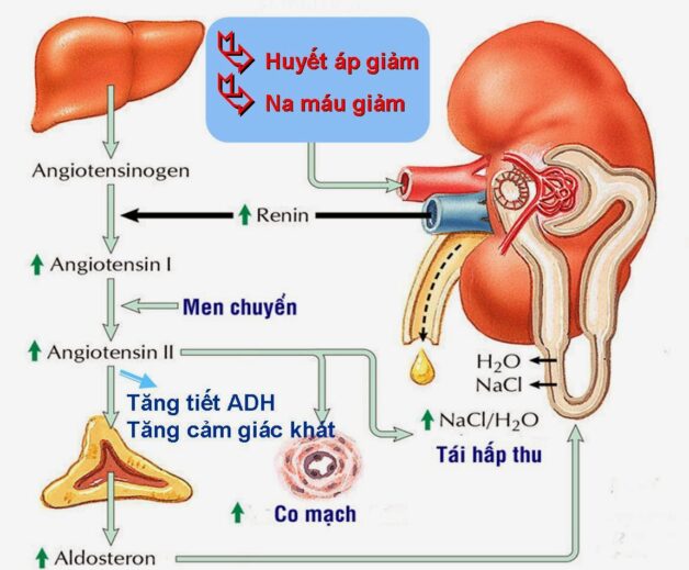 U tuyến thượng thận tăng tiết aldosteron