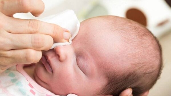 Vệ sinh sạch sẽ vùng mắt khi bé bị đau mắt đỏ