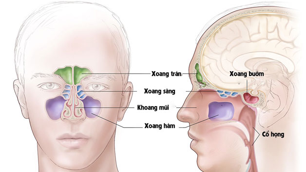 cách điều trị viêm xoang như thế nào