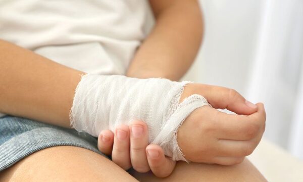 Chẩn đoán gãy xương cánh tay ở trẻ em