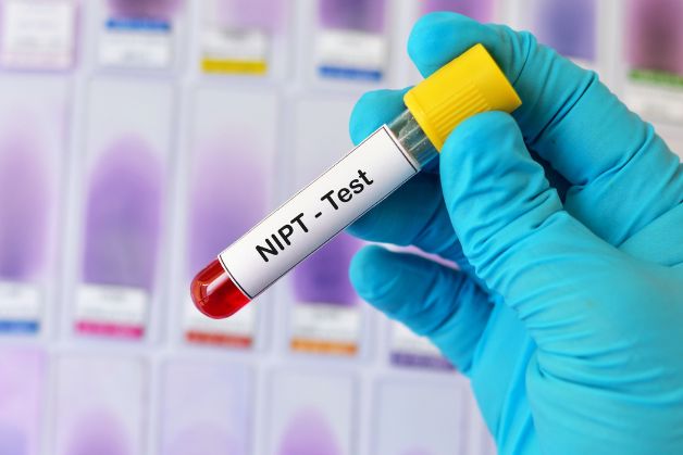 NIPT thường được sử dụng để phát hiện các bất thường nhiễm sắc thể cơ bản