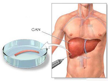 chi phí sinh thiết gan