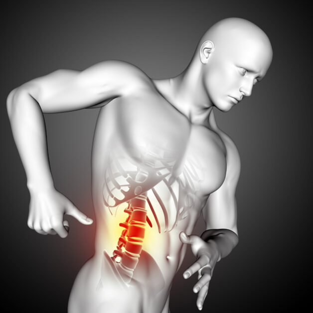 Thoát vị đĩa đệm đốt sống thắt lưng rất phổ biến.