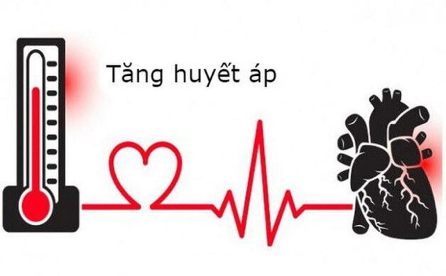 U tuyến thượng thận gây tăng huyết áp
