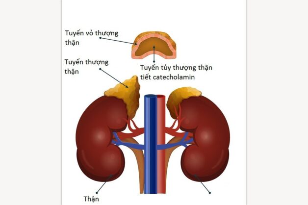 Hình ảnh khối tủy tuyến thượng thận