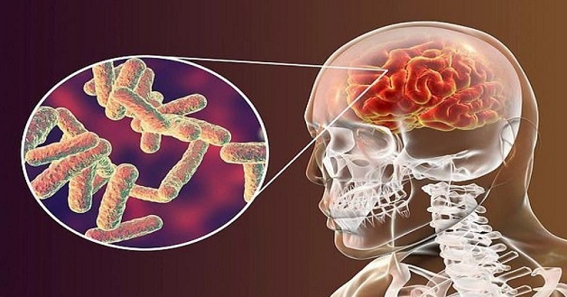 Vi khuẩn Hib là nguyên nhân chính của một số bệnh nhiễm trùng nguy hiểm ở trẻ em, hiện đã có thể chủng ngừa bằng vacxin Hib