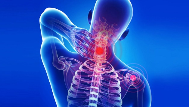 Vì sao thoái hóa đốt sống cổ gây thiếu máu não?