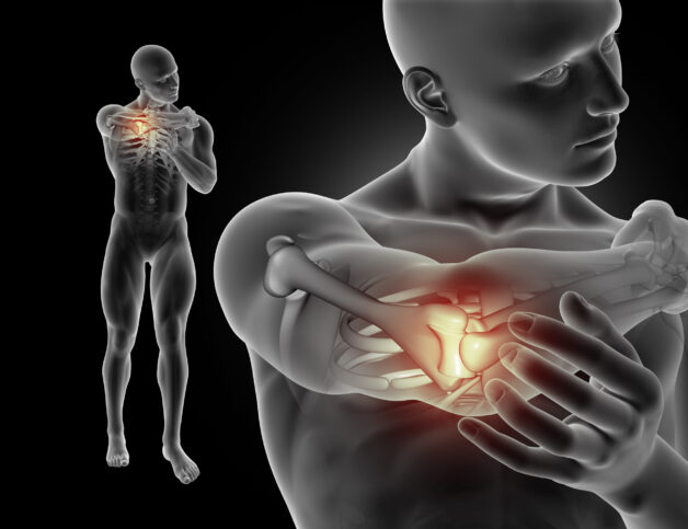 Viêm khớp dạng thấp là bệnh mãn tính.