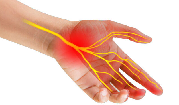 Viêm khớp dạng thấp có thể gây ra nhiều biến chứng nguy hiểm, ảnh hưởng đến sức khỏe xương khớp