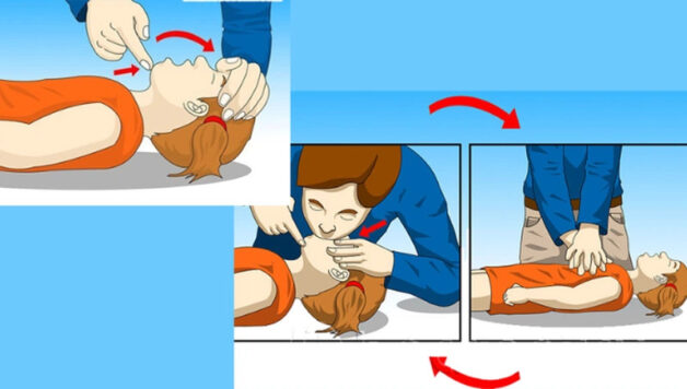 Tránh hô hấp nhân tạo khi người bệnh lên cơn động kinh