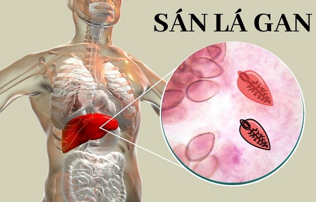 Sán lá gan gây tác hại gì cho vật chủ trong quá trình ký sinh?