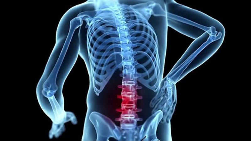 Bệnh viêm cột sống dính khớp