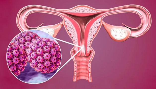 Hiện có tới gần 200 chủng virus HPV, trong đó, có khoảng 40 chủng gây các bệnh đường sinh dục